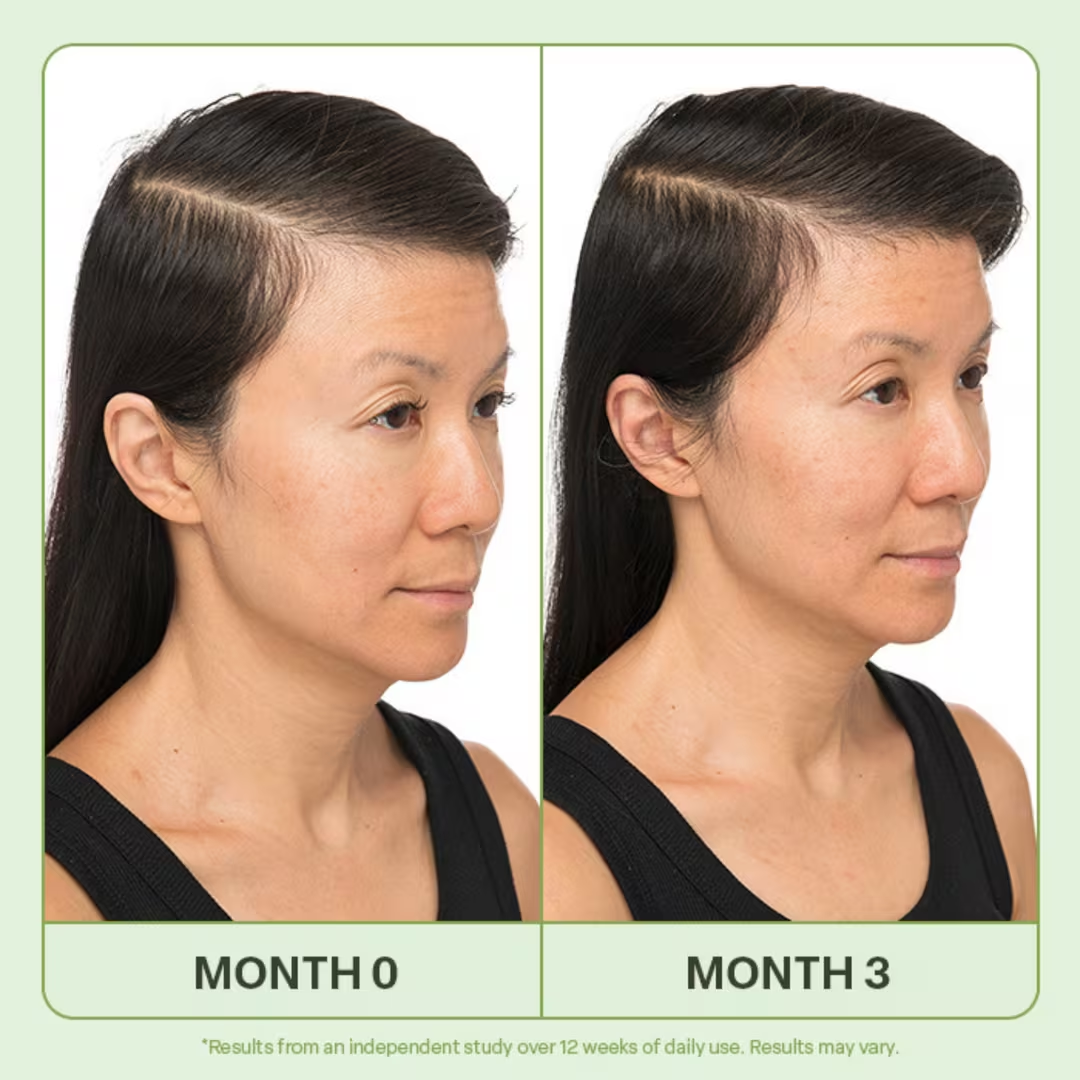 Scalp Serum